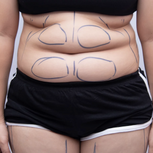 Aesthetics Treatments in Brixton